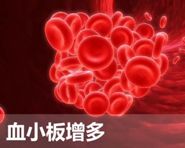 血小板增多:是警示,更是治疗信号?
