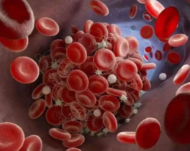 详解贫血三项检查:评估贫血原因的血清学指标