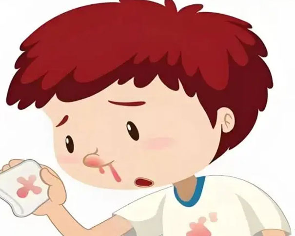 血液病患者鼻出血怎么办?牢记预防、冷静与正确止血