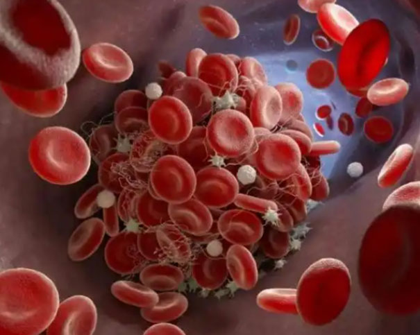 当红细胞“变形记”上演:八种异常细胞形态背后的健康警示